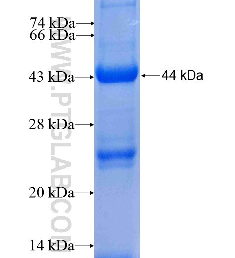 ZADH2 fusion protein Ag7136 SDS-PAGE ZADH2 fusion protein Ag7136 SDS-PAGE