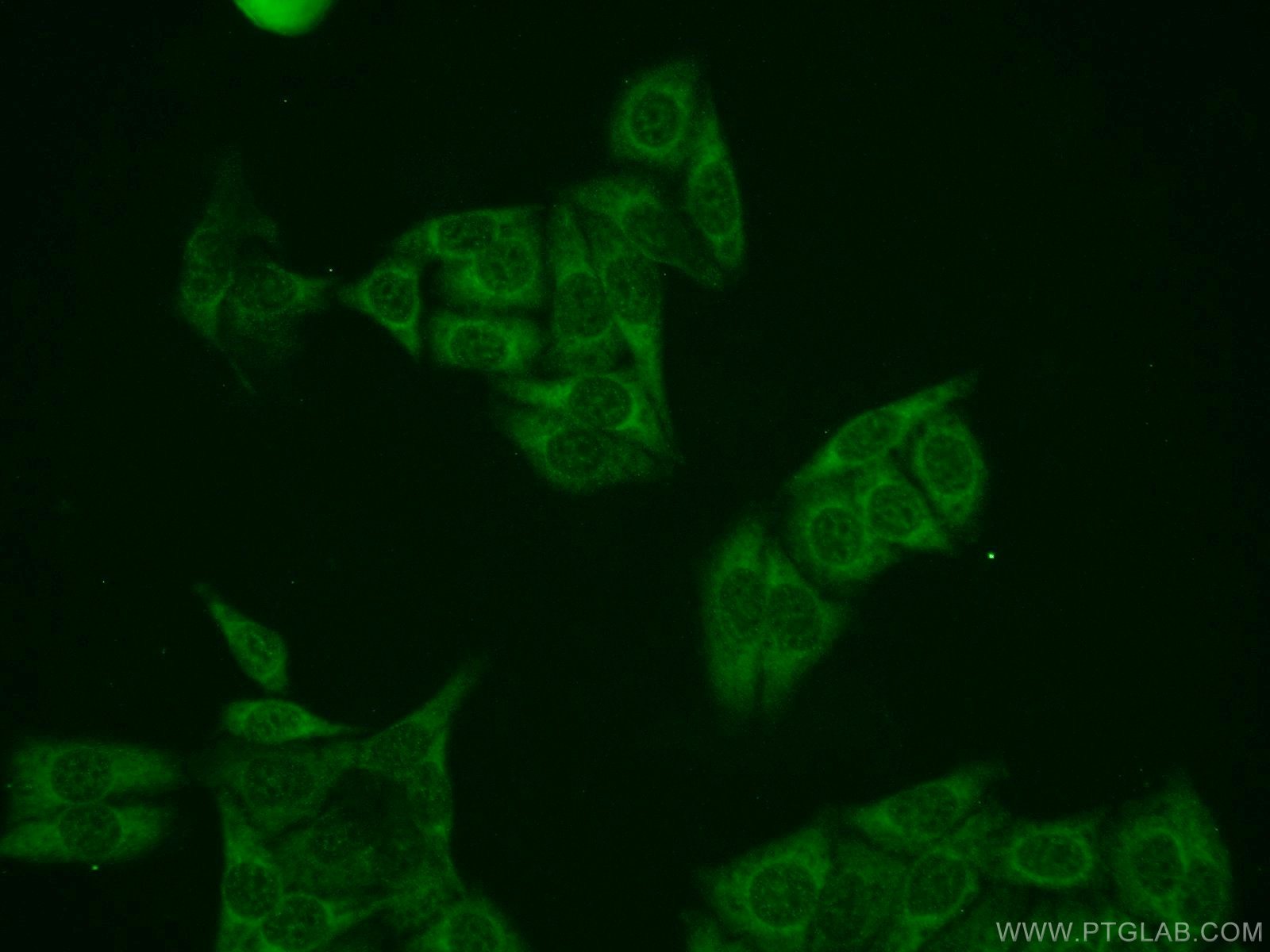 Immunofluorescence (IF) / fluorescent staining of HepG2 cells using ZAK Polyclonal antibody (14945-1-AP)