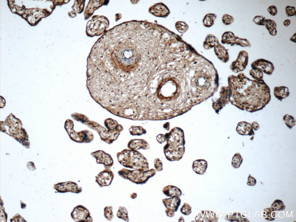 Immunohistochemistry (IHC) staining of human placenta tissue using ZAK Polyclonal antibody (14945-1-AP)