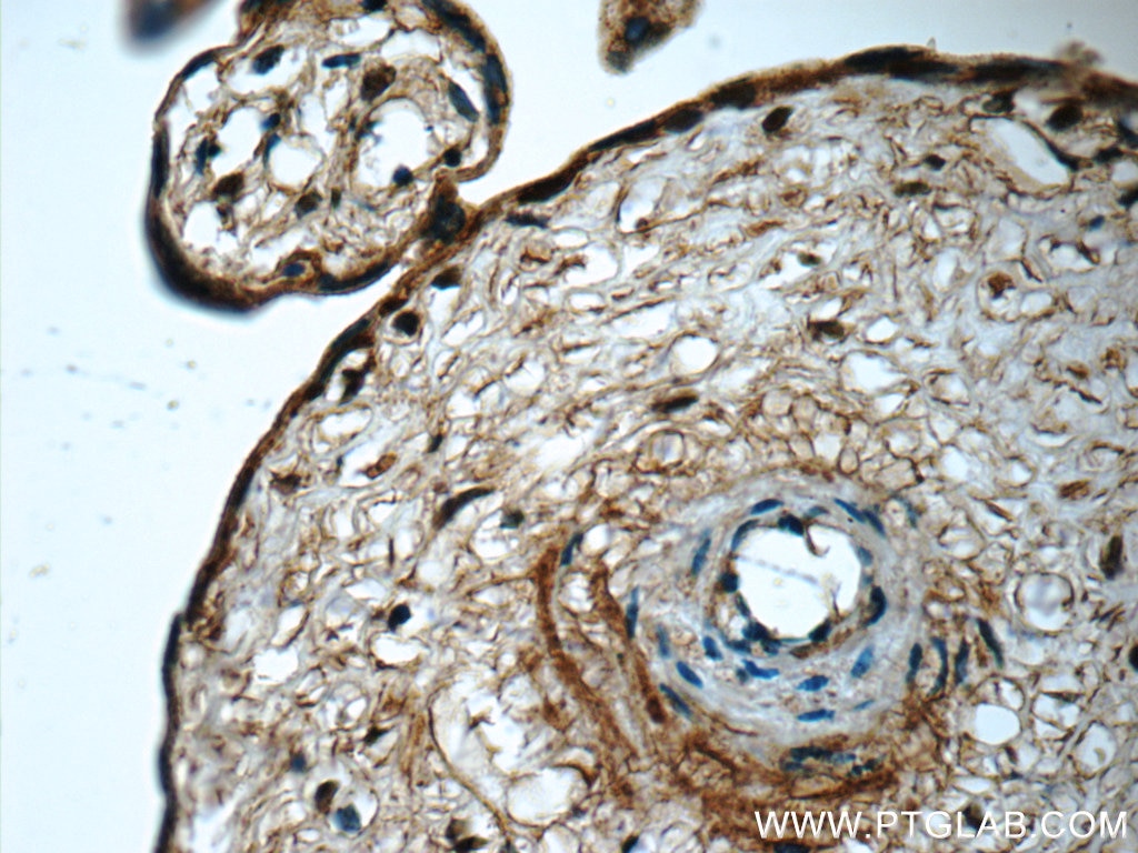 Immunohistochemistry (IHC) staining of human placenta tissue using ZAK Polyclonal antibody (14945-1-AP)