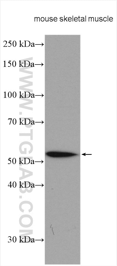 Western Blot (WB) analysis of various lysates using ZAK Polyclonal antibody (14945-1-AP)