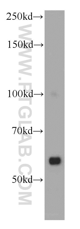 Western Blot (WB) analysis of human heart tissue using ZAK Polyclonal antibody (14945-1-AP)