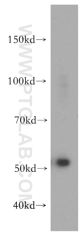 Western Blot (WB) analysis of human skeletal muscle tissue using ZAK Polyclonal antibody (14945-1-AP)