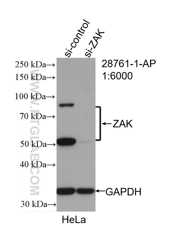 Western Blot (WB) analysis of HeLa cells using ZAK Polyclonal antibody (28761-1-AP)