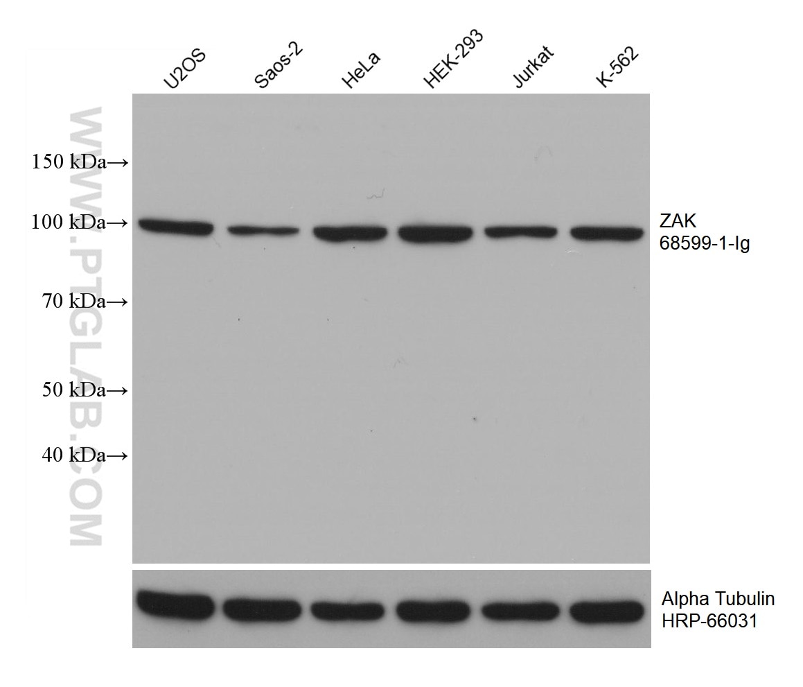 Western Blot (WB) analysis of various lysates using ZAK Monoclonal antibody (68599-1-Ig)
