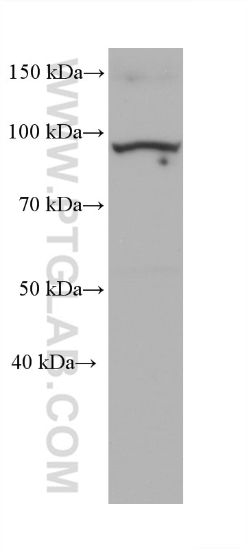Western Blot (WB) analysis of rat skeletal muscle tissue using ZAK Monoclonal antibody (68599-1-Ig)