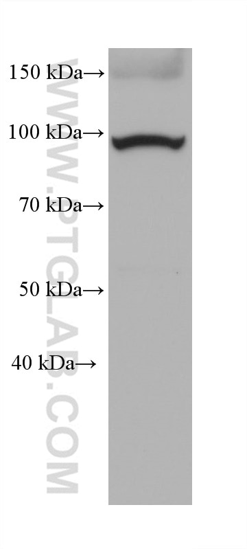 Western Blot (WB) analysis of rabbit skeletal muscle tissue using ZAK Monoclonal antibody (68599-1-Ig)