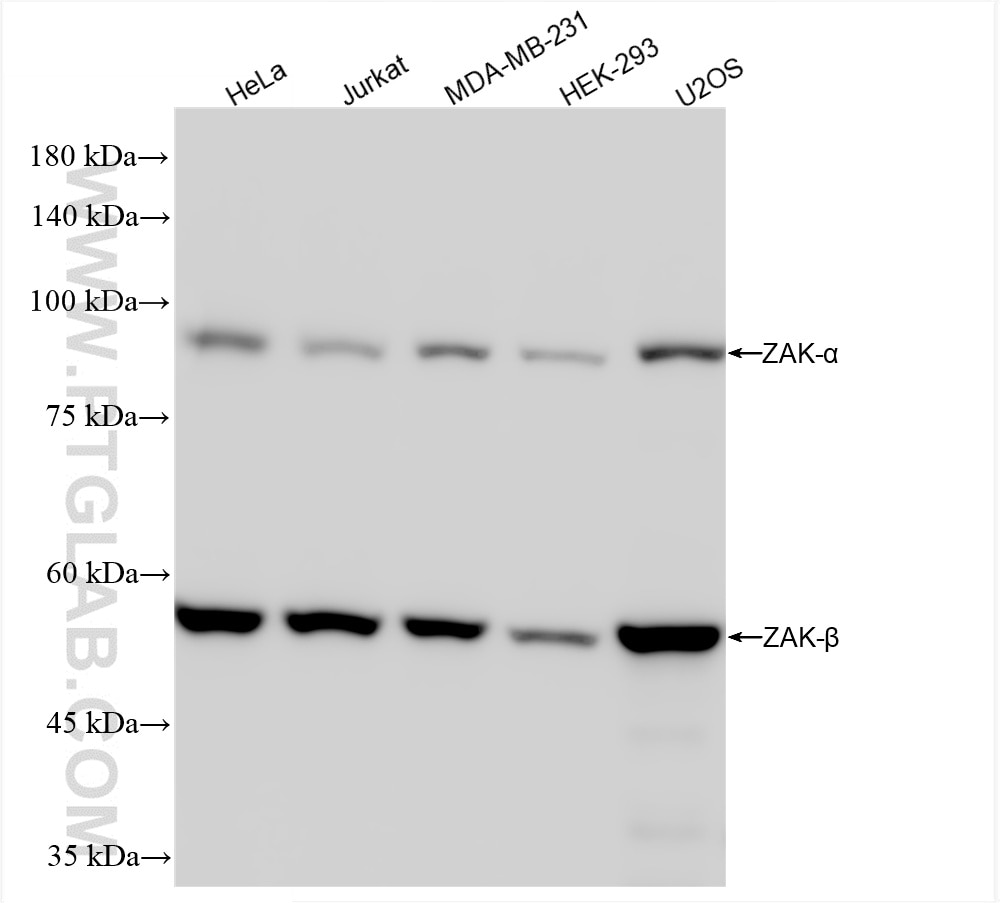 Western Blot (WB) analysis of various lysates using ZAK Recombinant antibody (81161-2-RR)