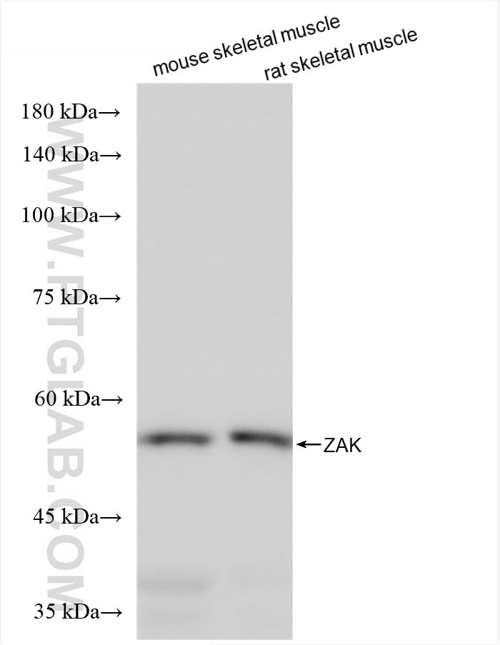 Western Blot (WB) analysis of various lysates using ZAK Recombinant antibody (81161-2-RR)