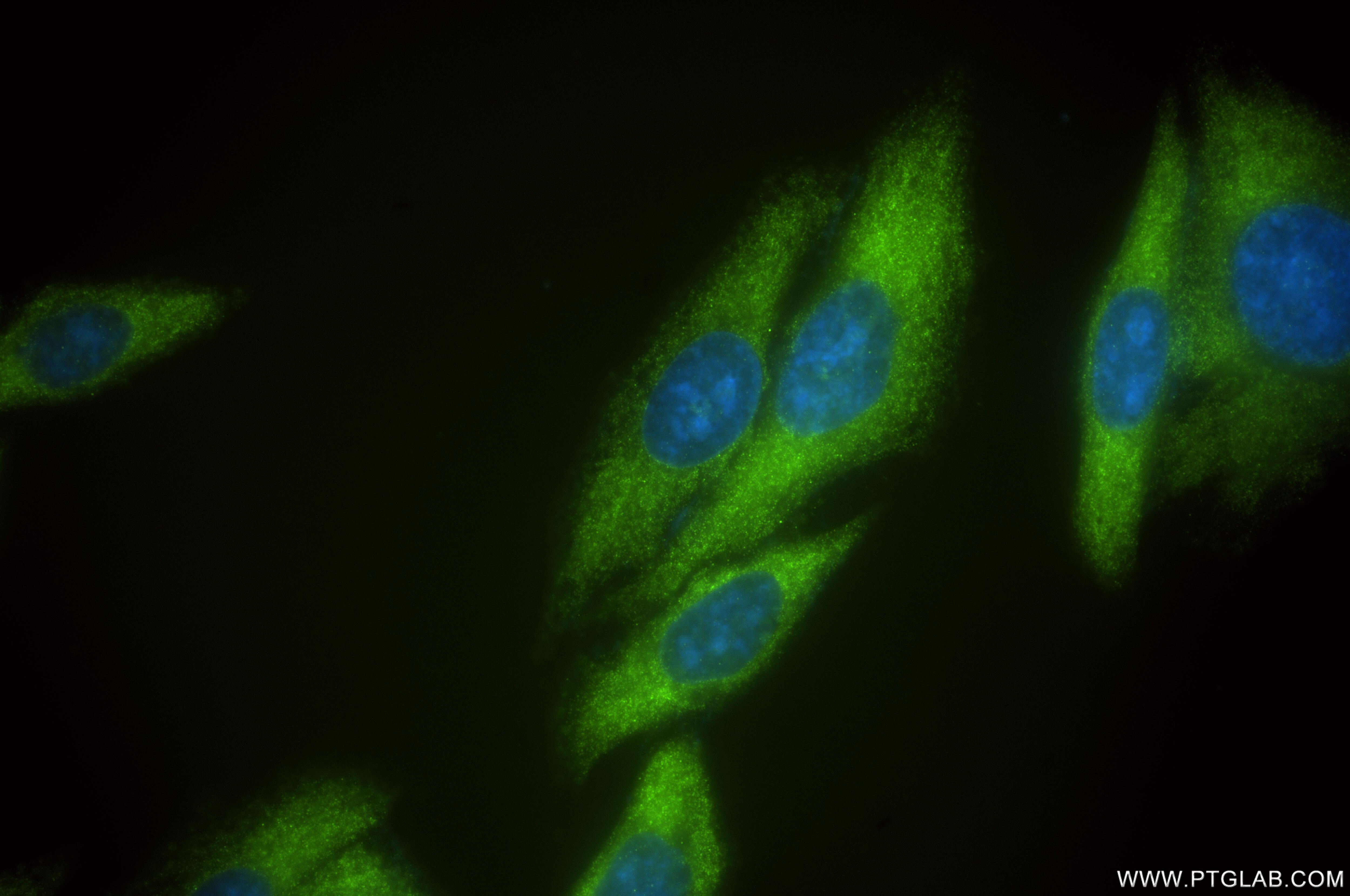 Immunofluorescence (IF) / fluorescent staining of HepG2 cells using ZAK Recombinant antibody (81161-3-RR)