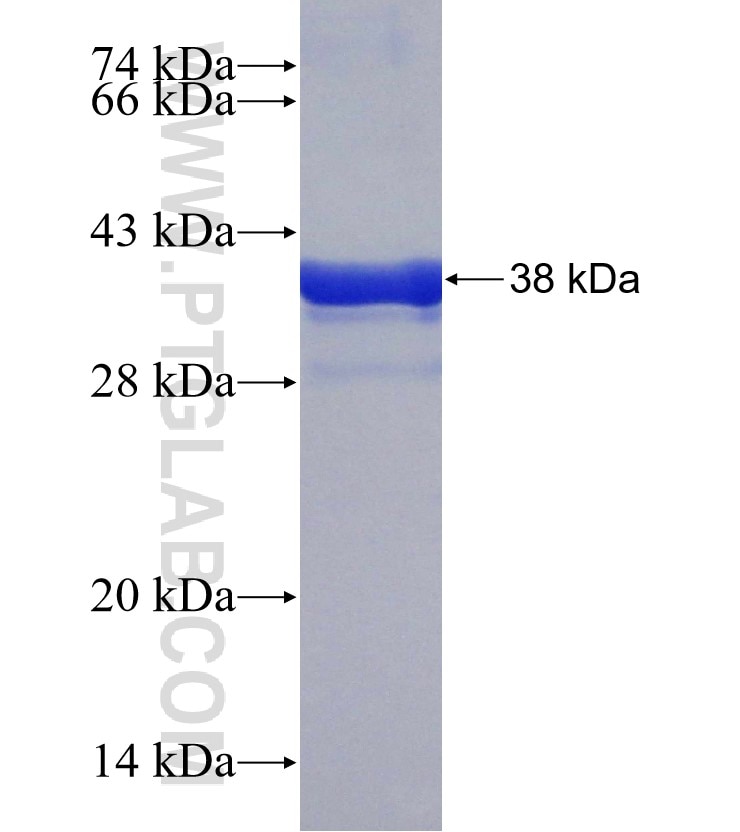 ZAK fusion protein Ag30599 SDS-PAGE