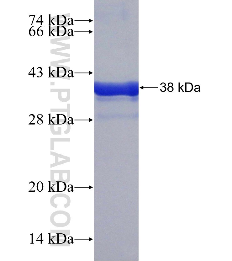 ZAK fusion protein Ag30599 SDS-PAGE