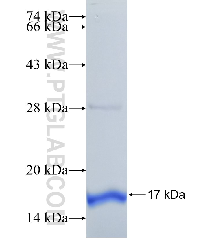ZAK fusion protein Ag30623 SDS-PAGE