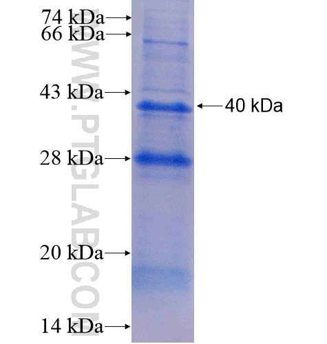 ZAK fusion protein Ag6747 SDS-PAGE