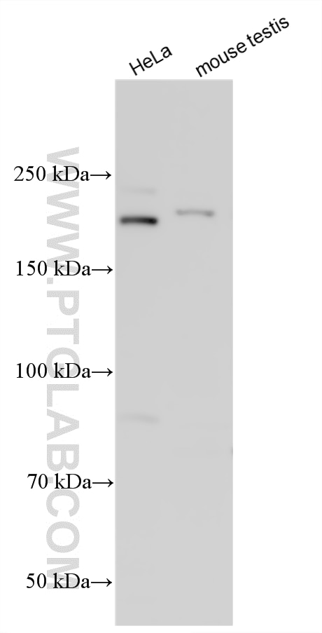 Western Blot (WB) analysis of various lysates using ZAN Polyclonal antibody (33956-1-AP)