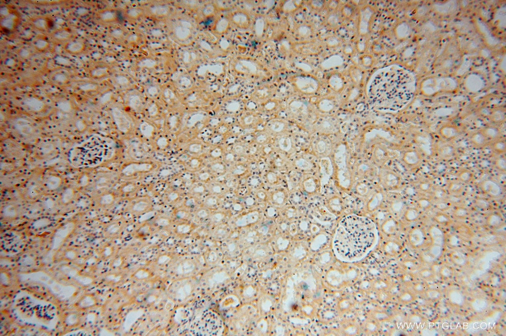 Immunohistochemistry (IHC) staining of human kidney tissue using ZAP70 Polyclonal antibody (15592-1-AP)