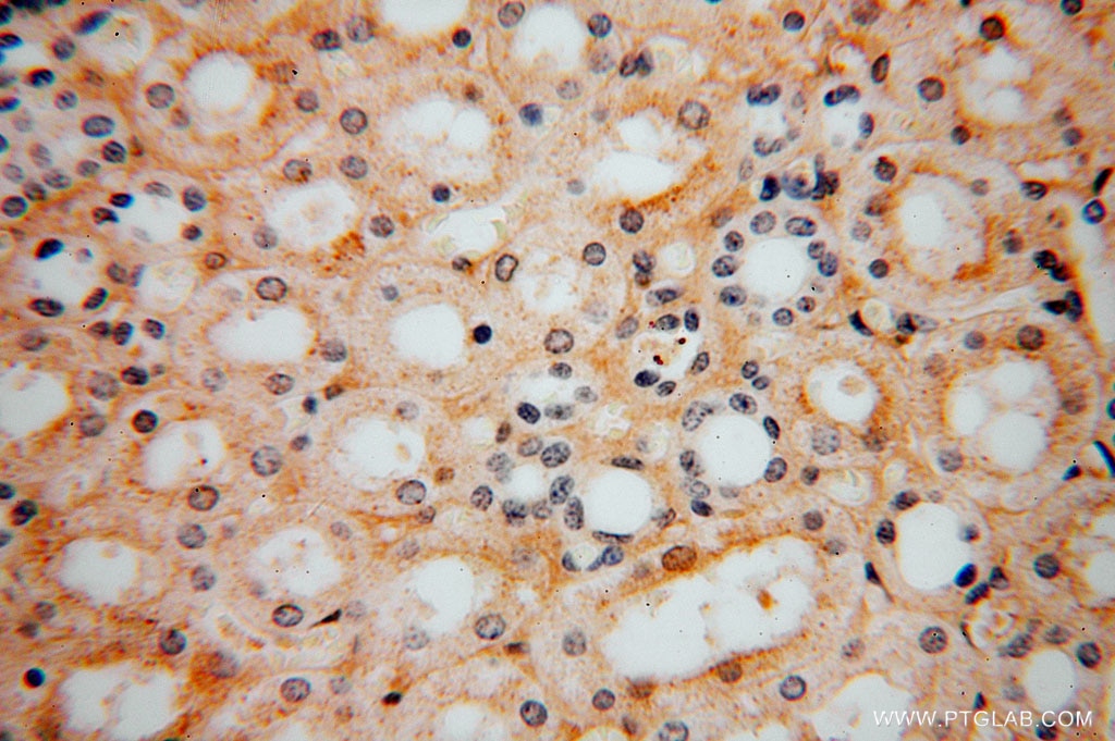 Immunohistochemistry (IHC) staining of human kidney tissue using ZAP70 Polyclonal antibody (15592-1-AP)