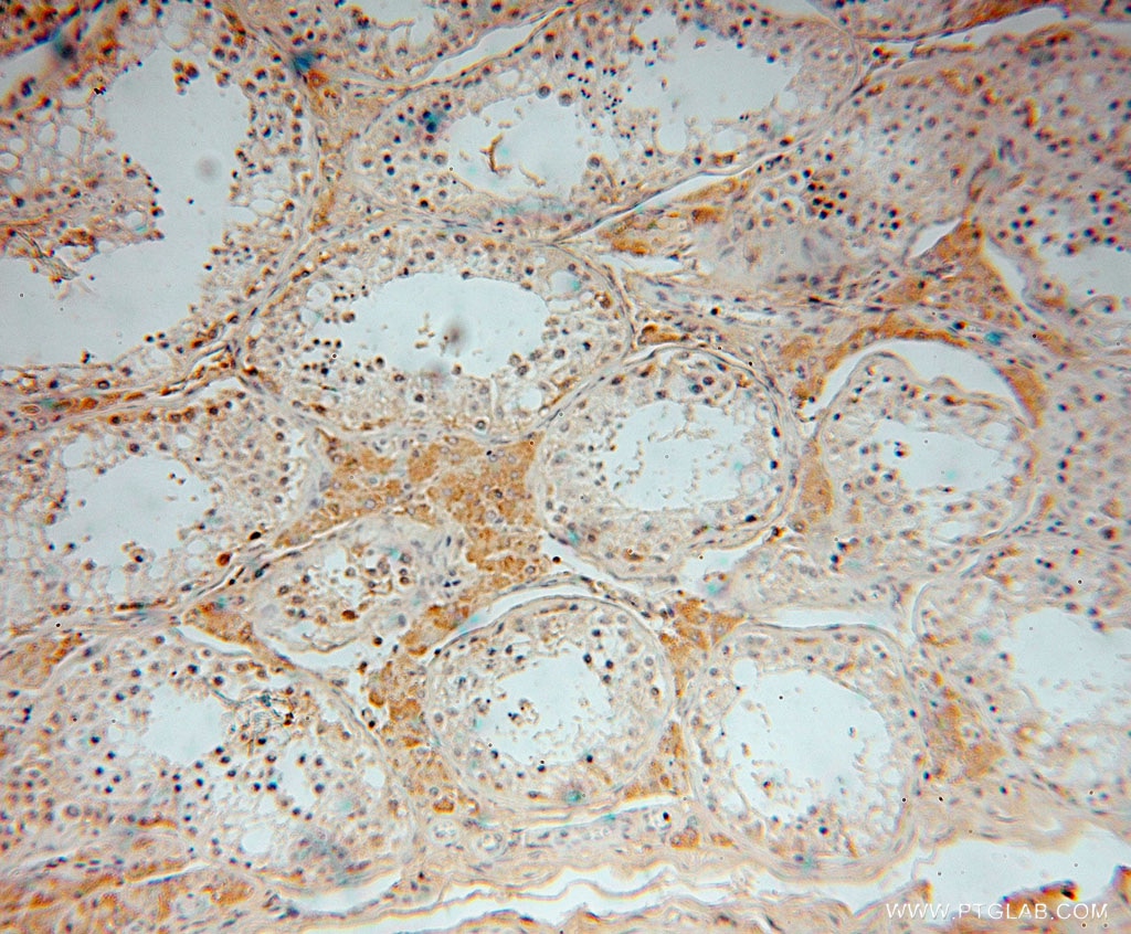 Immunohistochemistry (IHC) staining of human testis tissue using ZAP70 Polyclonal antibody (15592-1-AP)