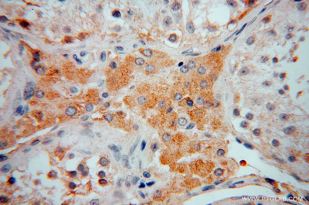 Immunohistochemistry (IHC) staining of human testis tissue using ZAP70 Polyclonal antibody (15592-1-AP)