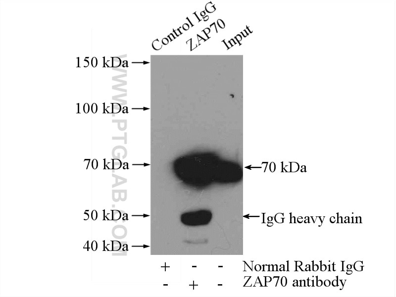 Immunoprecipitation (IP) experiment of Jurkat cells using ZAP70 Polyclonal antibody (15592-1-AP)