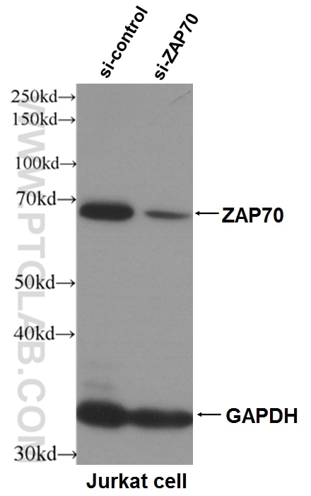 Western Blot (WB) analysis of Jurkat cells using ZAP70 Polyclonal antibody (15592-1-AP)