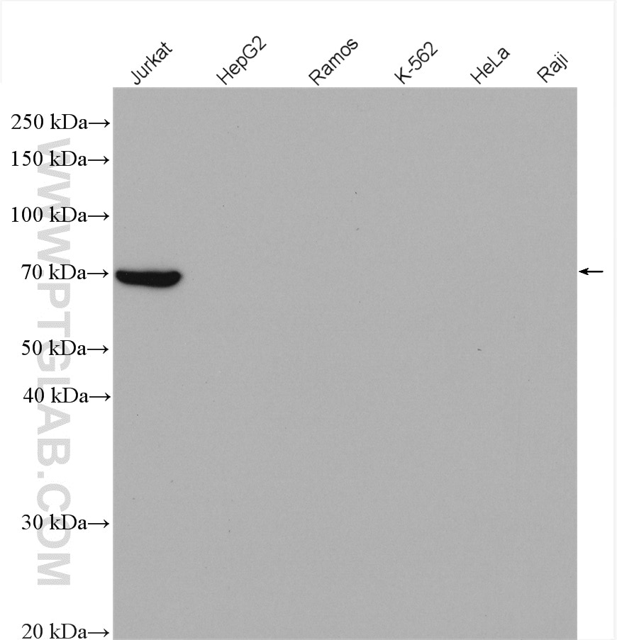 Western Blot (WB) analysis of various lysates using ZAP70 Polyclonal antibody (15592-1-AP)