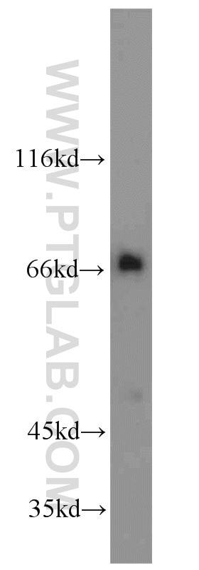 Western Blot (WB) analysis of Jurkat cells using ZAP70 Polyclonal antibody (15592-1-AP)