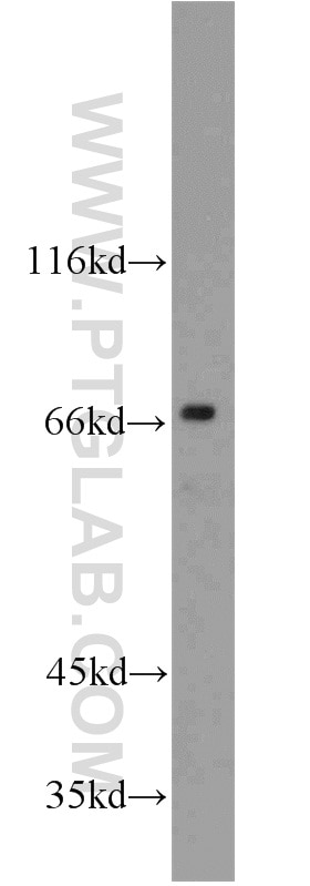 Western Blot (WB) analysis of A375 cells using ZAP70 Polyclonal antibody (15592-1-AP)