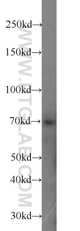 Western Blot (WB) analysis of A375 cells using ZAP70 Polyclonal antibody (15592-1-AP)