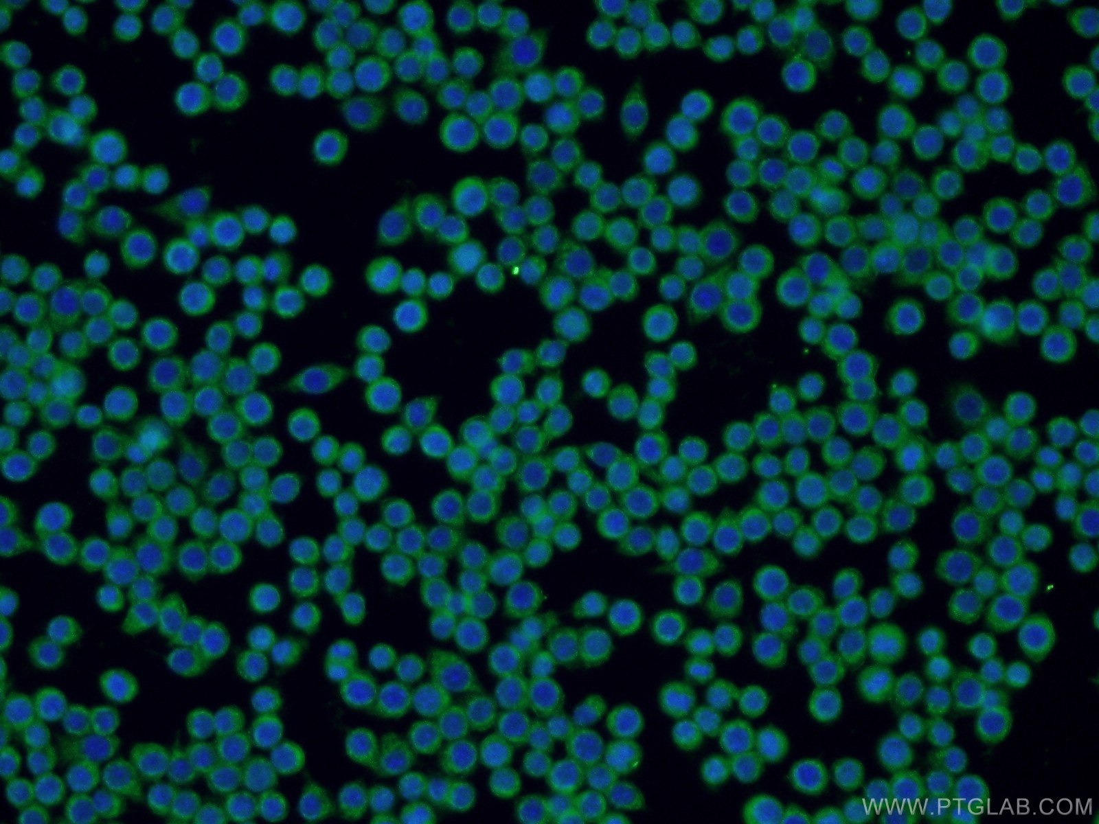 Immunofluorescence (IF) / fluorescent staining of RAW 264.7 cells using ZAP70 Polyclonal antibody (22207-1-AP)