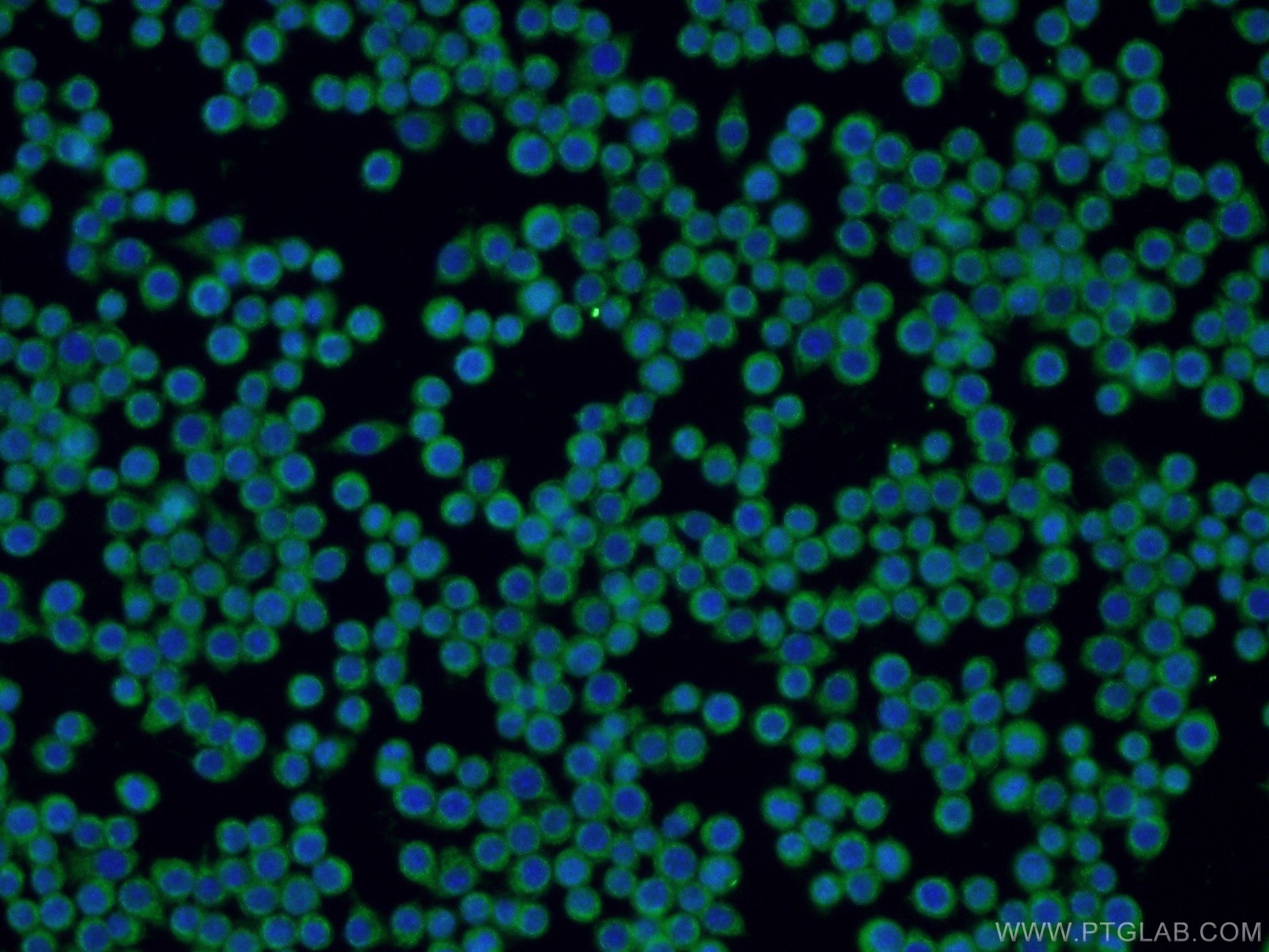 IF Staining of RAW 264.7 using 22207-1-AP