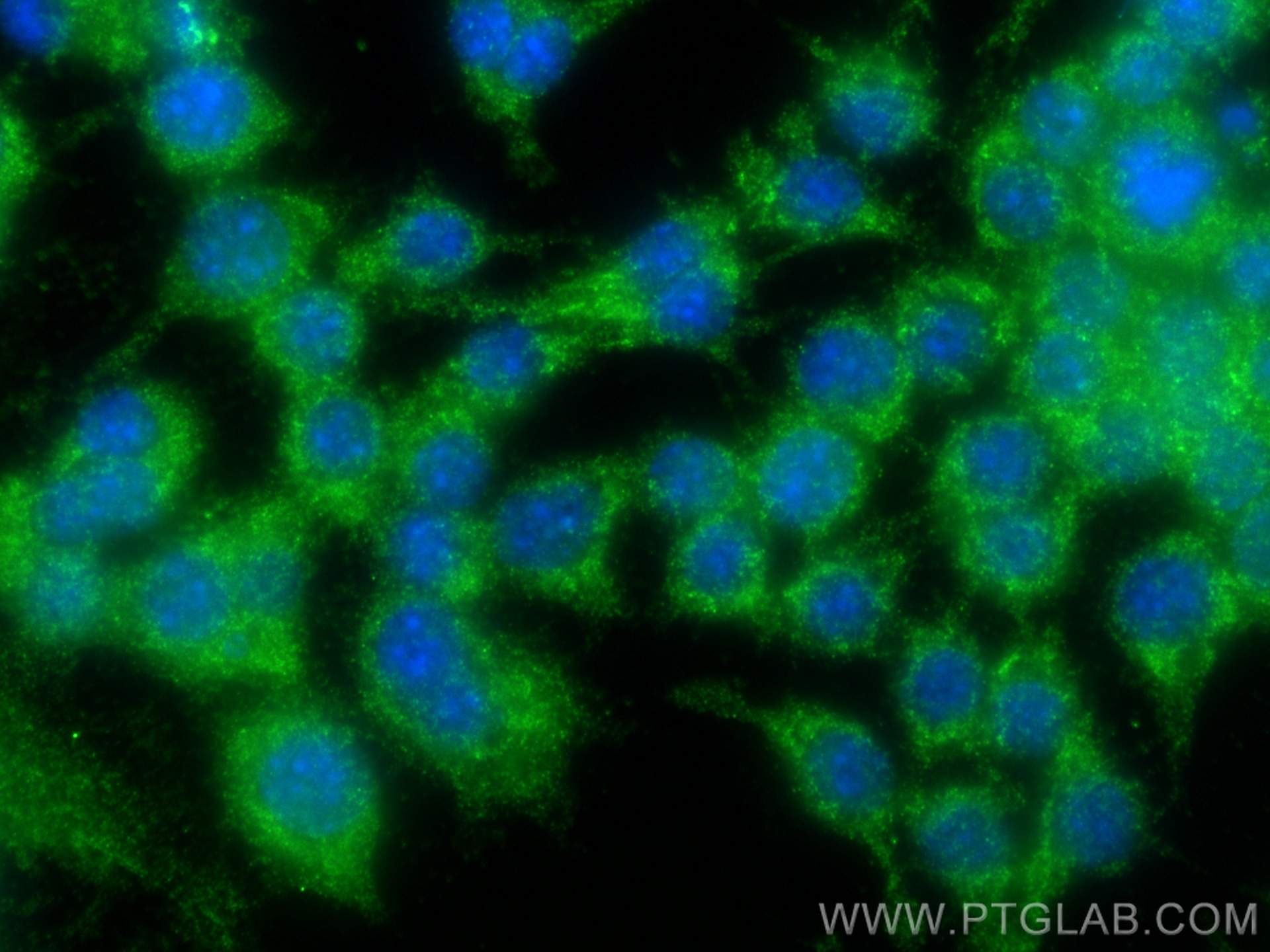 Immunofluorescence (IF) / fluorescent staining of RAW 264.7 cells using ZAP70 Polyclonal antibody (22207-1-AP)