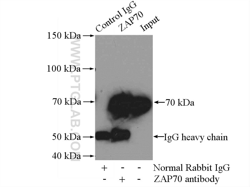 Immunoprecipitation (IP) experiment of Jurkat cells using ZAP70 Polyclonal antibody (22207-1-AP)