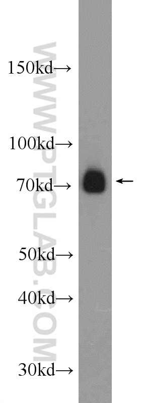 Western Blot (WB) analysis of Jurkat cells using ZAP70 Polyclonal antibody (22207-1-AP)