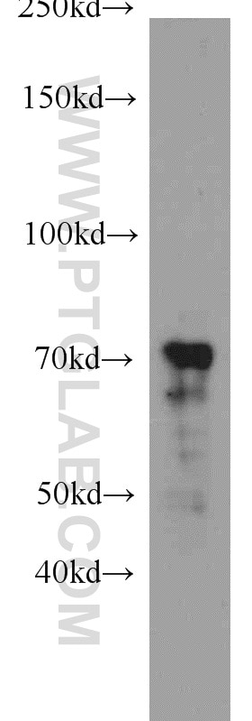 Western Blot (WB) analysis of RAW264.7 using ZAP70 Polyclonal antibody (22207-1-AP)