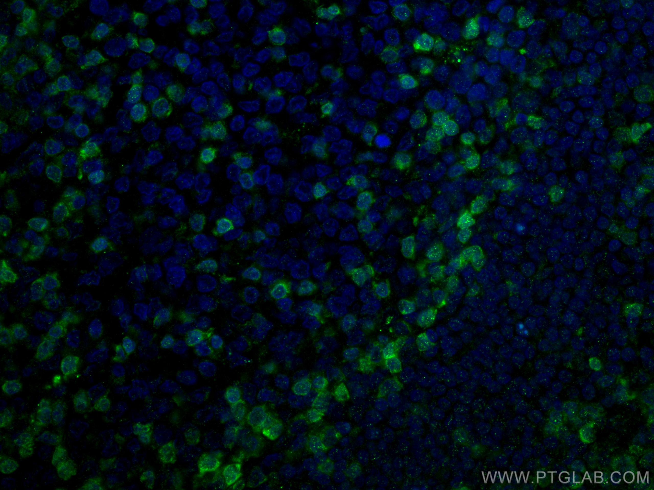 Immunofluorescence (IF) / fluorescent staining of human tonsillitis tissue using ZAP70 Monoclonal antibody (60200-1-Ig)