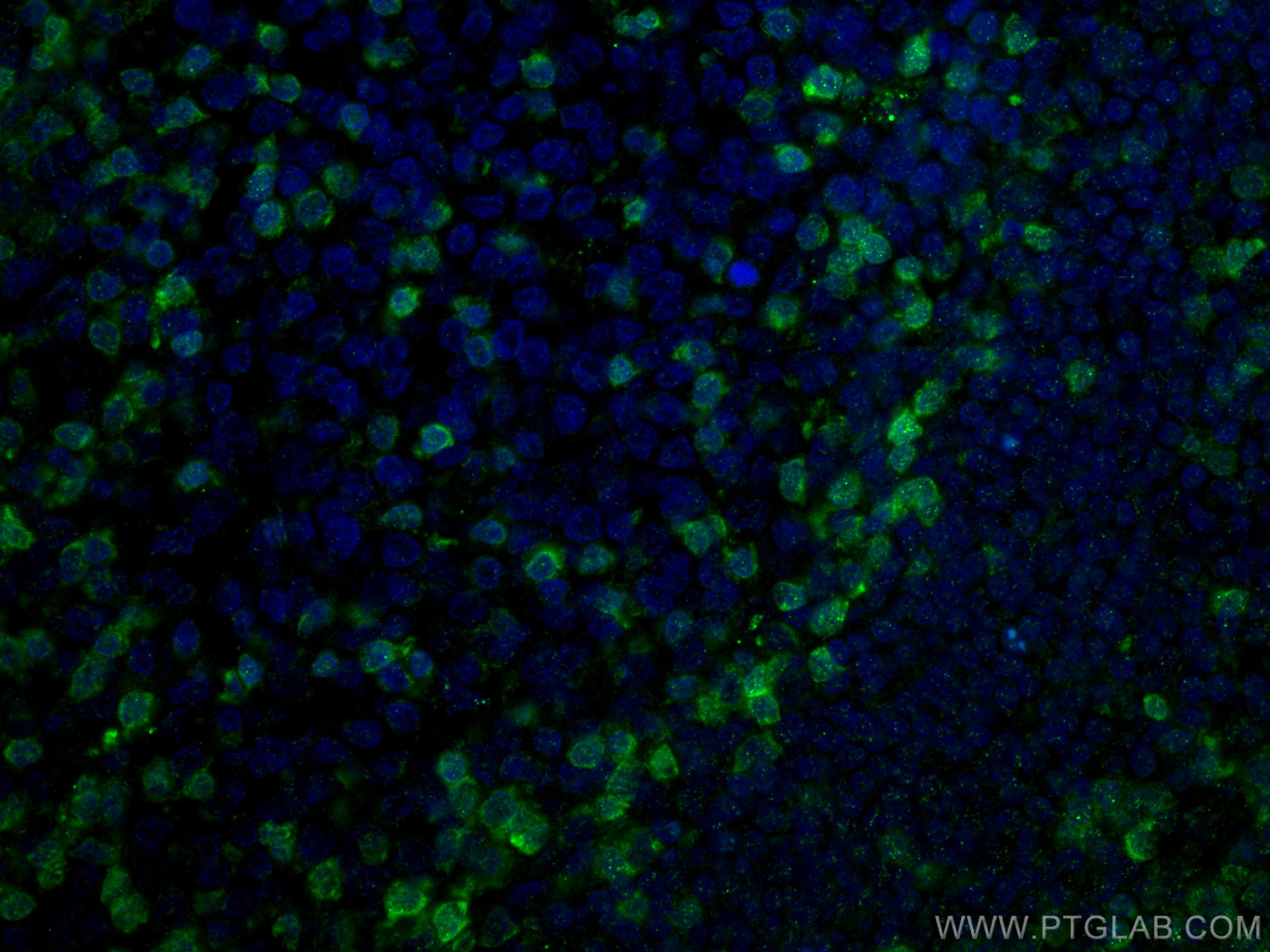 IF Staining of human tonsillitis using 60200-1-Ig