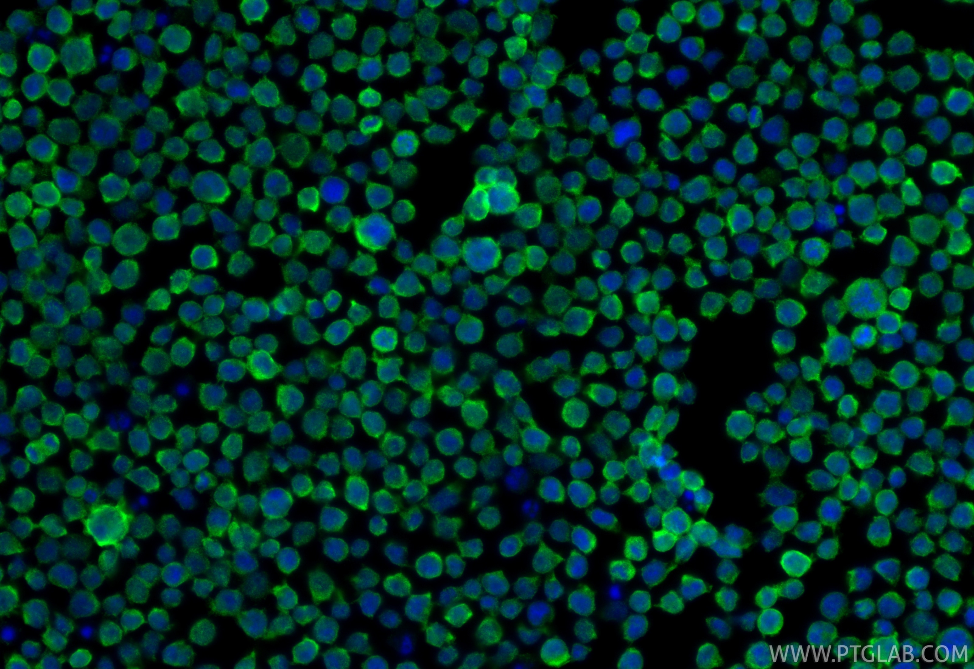 Immunofluorescence (IF) / fluorescent staining of Jurkat cells using ZAP70 Monoclonal antibody (60200-1-Ig)