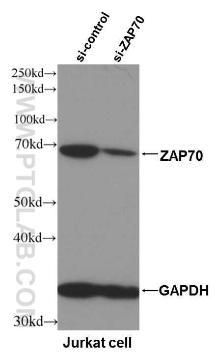 Western Blot (WB) analysis of Jurkat cells using ZAP70 Monoclonal antibody (60200-1-Ig)