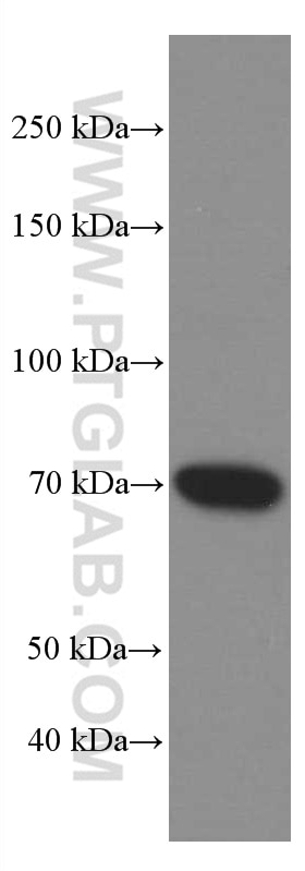 Western Blot (WB) analysis of Jurkat cells using ZAP70 Monoclonal antibody (60200-1-Ig)
