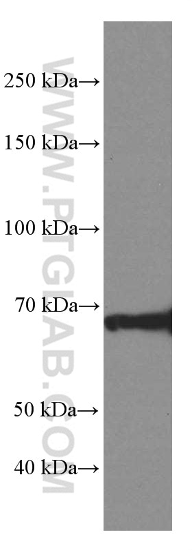 Western Blot (WB) analysis of pig spleen tissue using ZAP70 Monoclonal antibody (60200-1-Ig)