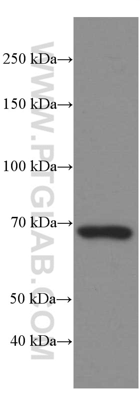 Western Blot (WB) analysis of pig thymus tissue using ZAP70 Monoclonal antibody (60200-1-Ig)