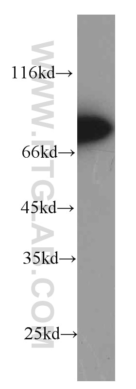 Western Blot (WB) analysis of Jurkat cells using ZAP70 Monoclonal antibody (60200-1-Ig)
