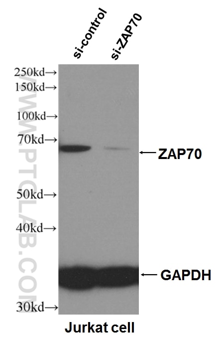 Western Blot (WB) analysis of Jurkat cells using ZAP70 Monoclonal antibody (60200-2-Ig)