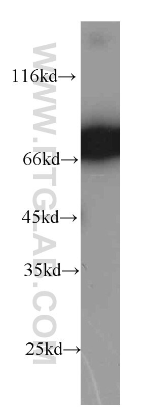 Western Blot (WB) analysis of Jurkat cells using ZAP70 Monoclonal antibody (60200-2-Ig)