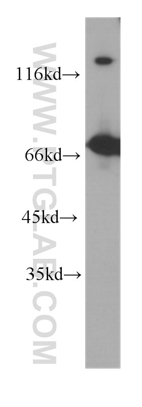 Western Blot (WB) analysis of Jurkat cells using ZAP70 Monoclonal antibody (60200-2-Ig)