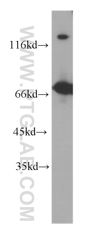 WB analysis of Jurkat using 60200-2-Ig