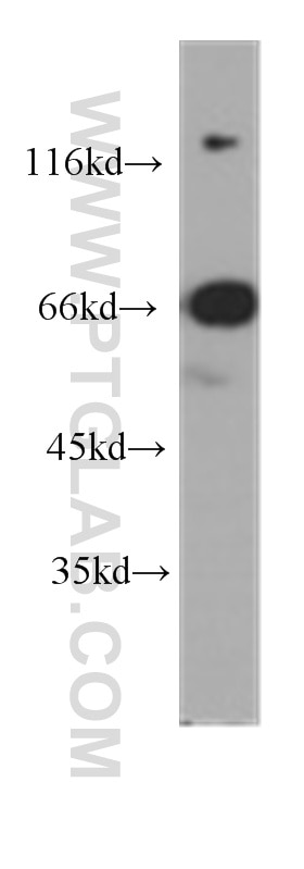 Western Blot (WB) analysis of Jurkat cells using ZAP70 Monoclonal antibody (60200-2-Ig)