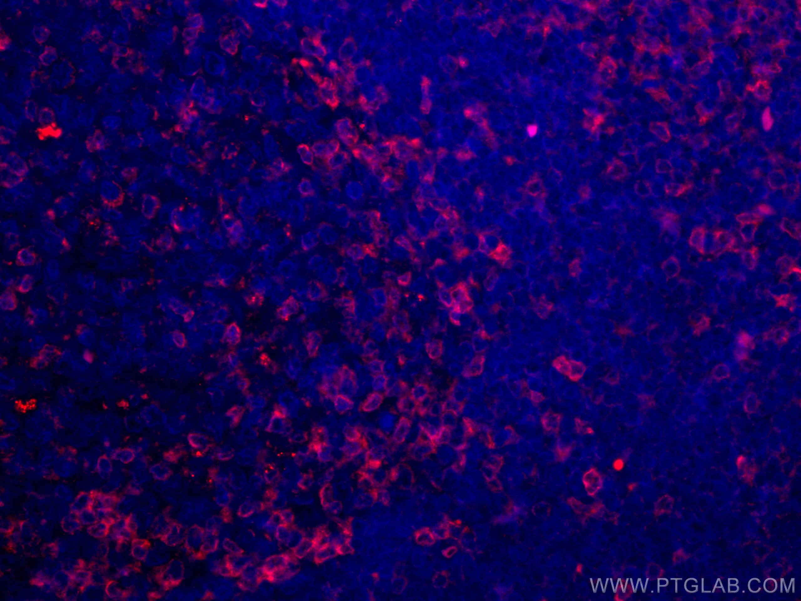 Immunofluorescence (IF) / fluorescent staining of human tonsillitis tissue using CoraLite®594-conjugated ZAP70 Monoclonal antibody (CL594-60200)