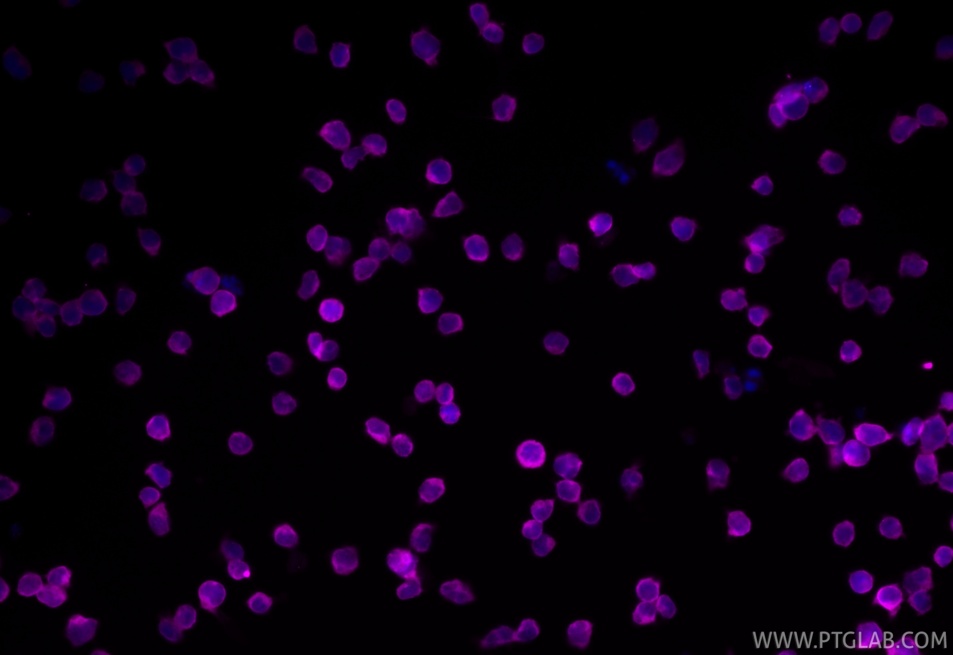 Immunofluorescence (IF) / fluorescent staining of Jurkat cells using CoraLite® Plus 647-conjugated ZAP70 Monoclonal ant (CL647-60200)
